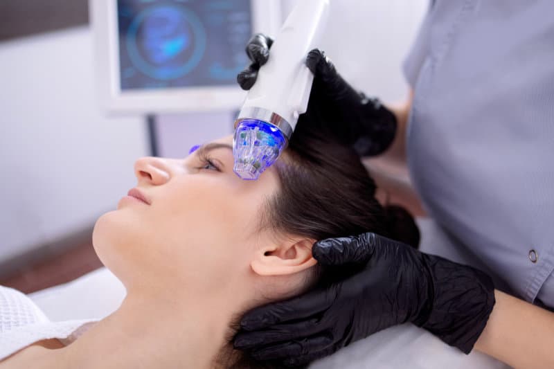 Female patient receiving microneedling treatment in Pasadena, CA