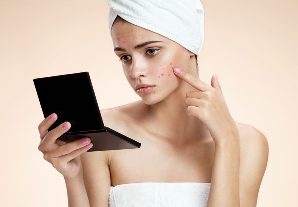 Woman visibly upset and in need of acne treatment, looking at a mirror and pointing to acne at her face